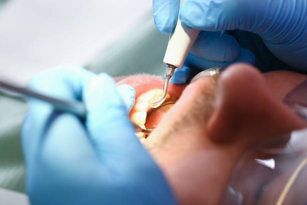 Best Walk-In Emergency Dental Services in Hoschton, GA