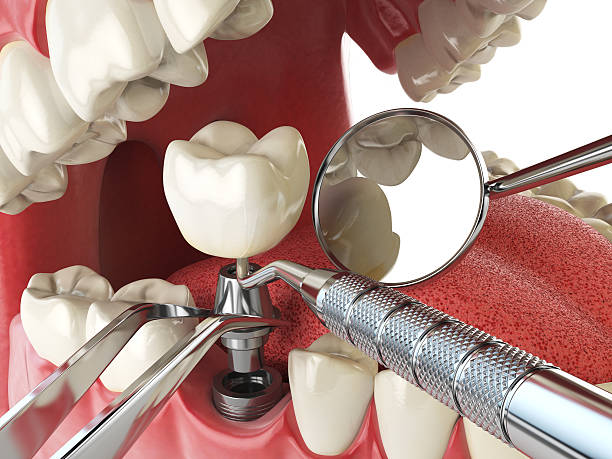 Reliable GA Emergency Dental Service Solutions